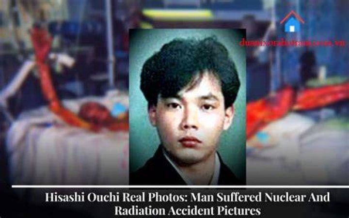 A Closer Look: Real Photographs Of Hisashi Ouchi's Story