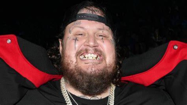 Are Jelly Roll's Teeth Rotten?