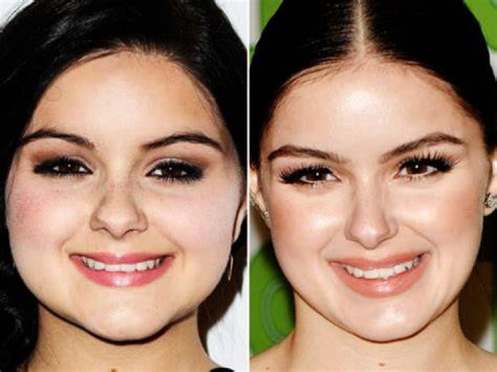 Ariel Winter&rsquo;s Before and After Breast Reduction Photos Show How Happy