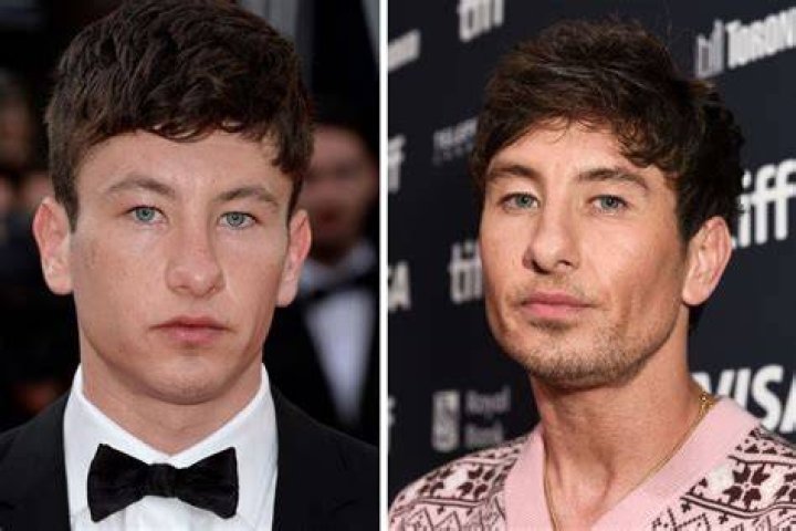 Barry Keoghan's Plastic Surgery: A Look At His Transformation