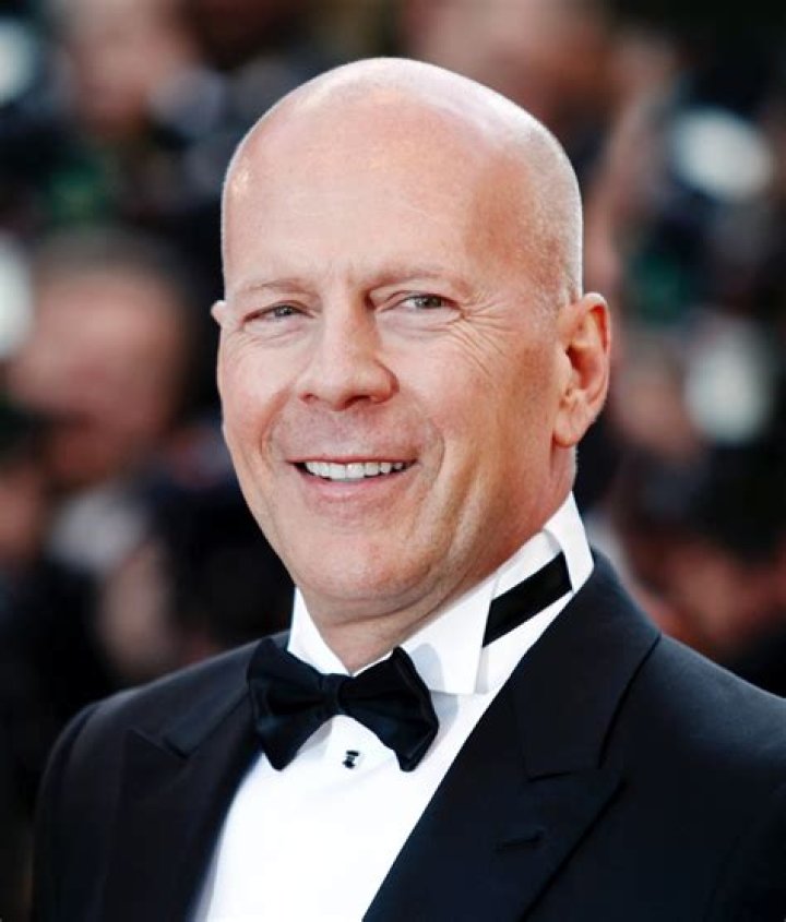 Celebrating Bald Celebrities: A Look At Iconic Figures Who Rock The Look