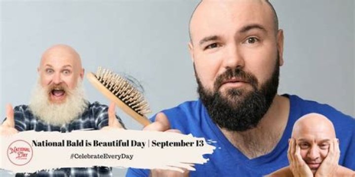 Celebrating Baldness: A Visual Tribute To Bald People