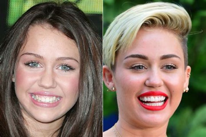 Celebrities who had bad teeth before they were stars HubPages