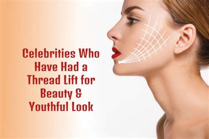 Celebrities Who Have Tautened With A Thread Lift