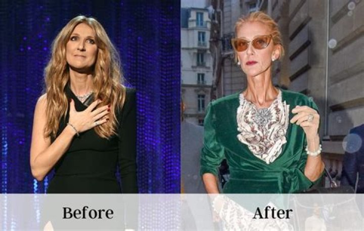 C&eacute;line Dion weight loss how did the singer lose weight? The Irish Sun