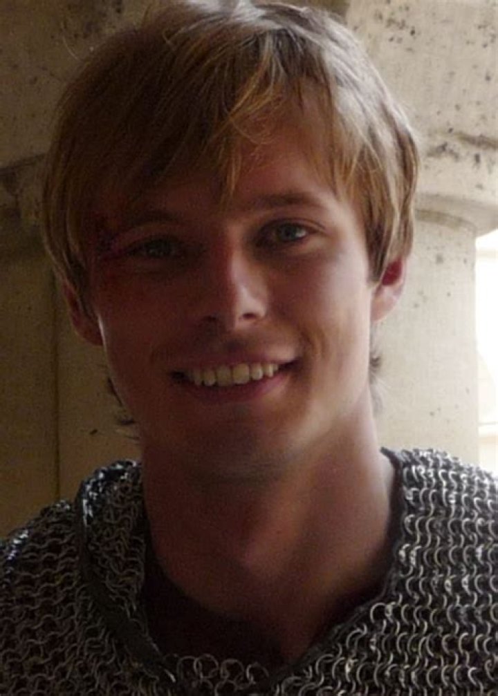 Did Bradley James Fix his Teeth? Why that's bad HubPages