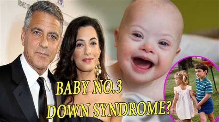 Does George Clooney's Son Have Down Syndrome? | Facts Unveiled