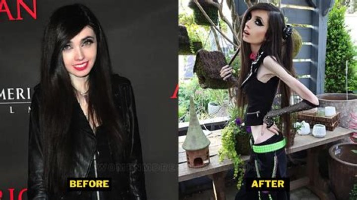 Eugenia Cooney's Weight Loss Story: From Body Dysmorphia To Recovery