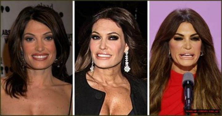 Exploring Kimberly Guilfoyle's Plastic Surgery Journey