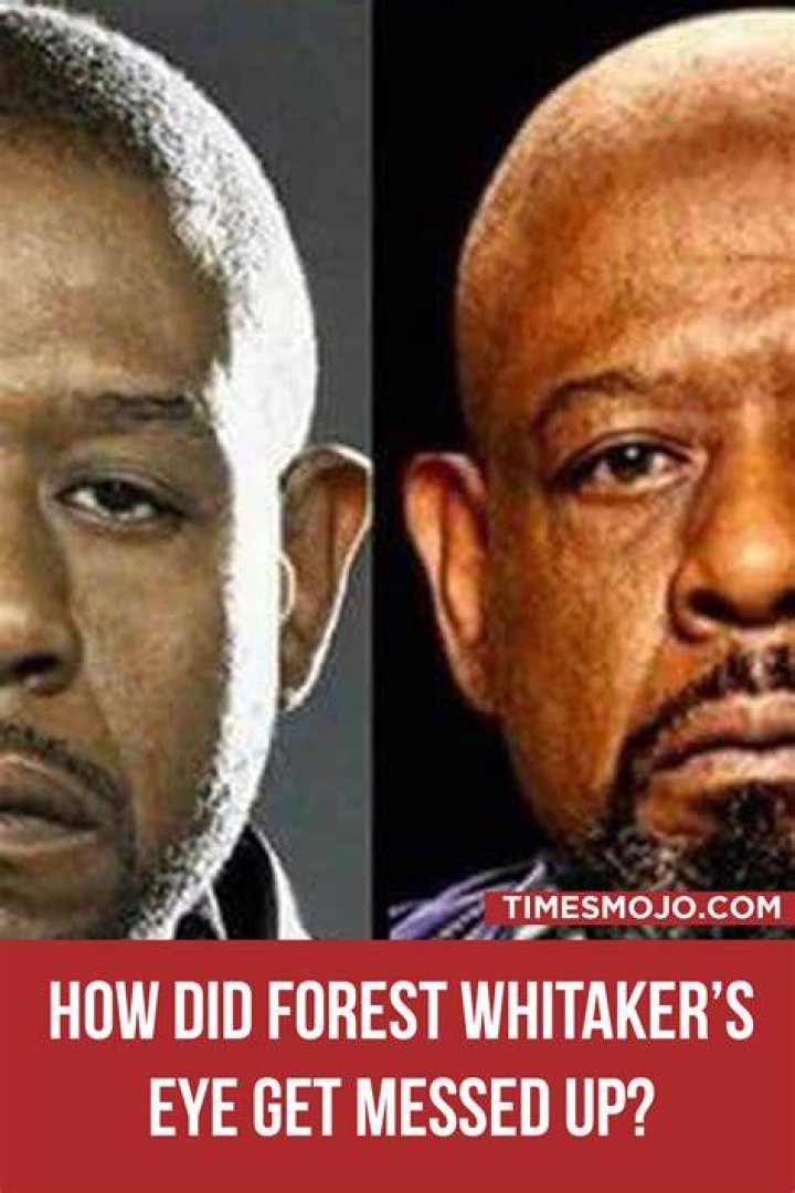 forest whitaker eye