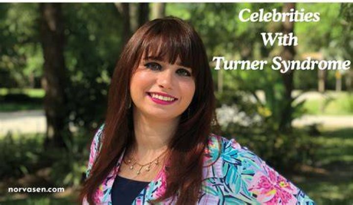 Illuminating The Spotlight: Actors With Turner Syndrome