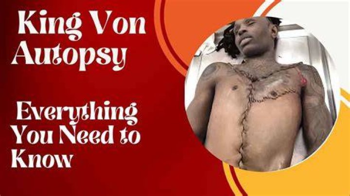 In-Depth Analysis: King Von Autopsy Report