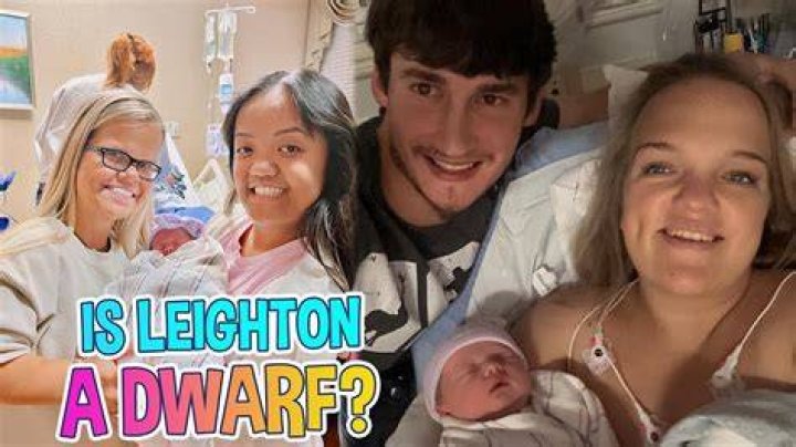 Is The Johnston Baby A Dwarf?