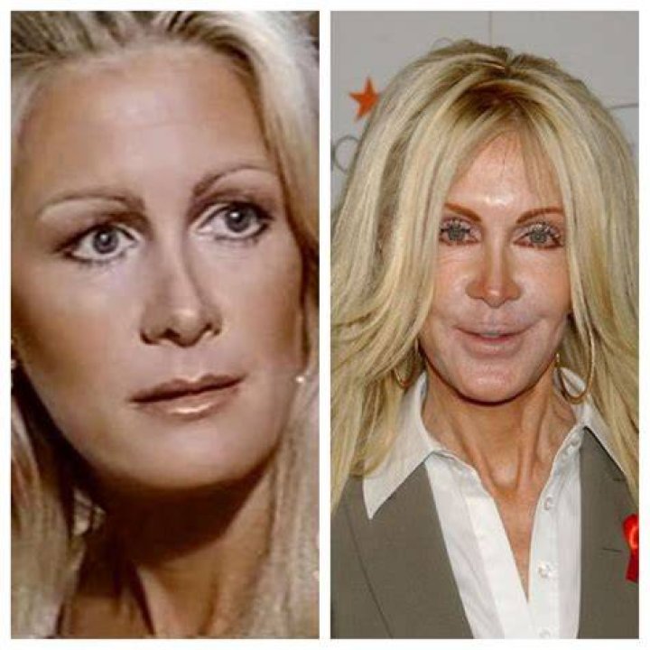 Joan Van Ark Heute: A Glimpse Into Her Life And Legacy