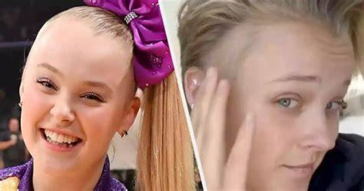 JoJo Siwa Reveals “Bald Spot” and Stress Rash From Dance Moms