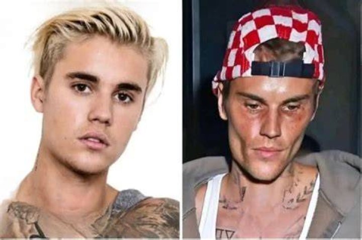 Justin Bieber's Tragic Loss Leaves Fans Heartbroken