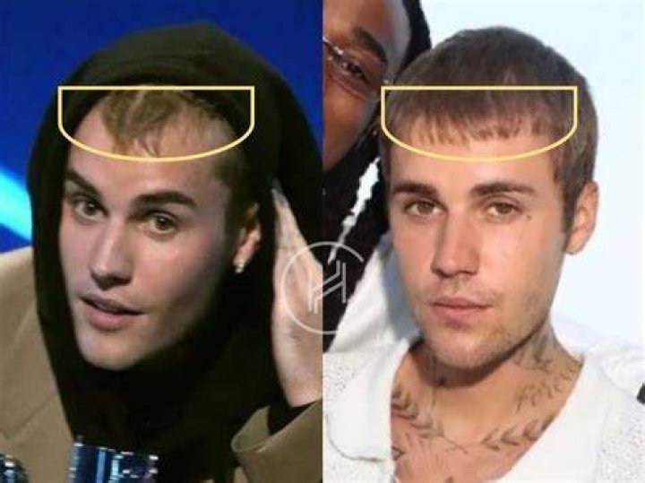 Justin Bieber's Weight Loss Transformation: A Timeline Of His Journey