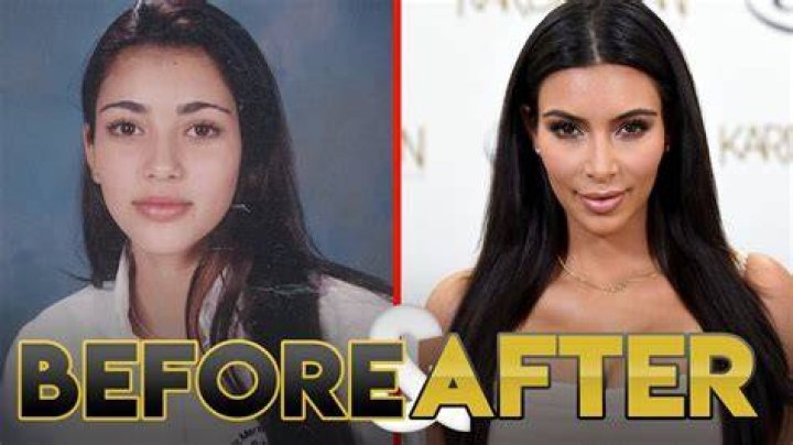 Kim Kardashian Before Surgery: The Transformation Uncovered