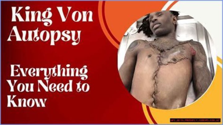 King Von Autopsy Report Reveals Startling Insights