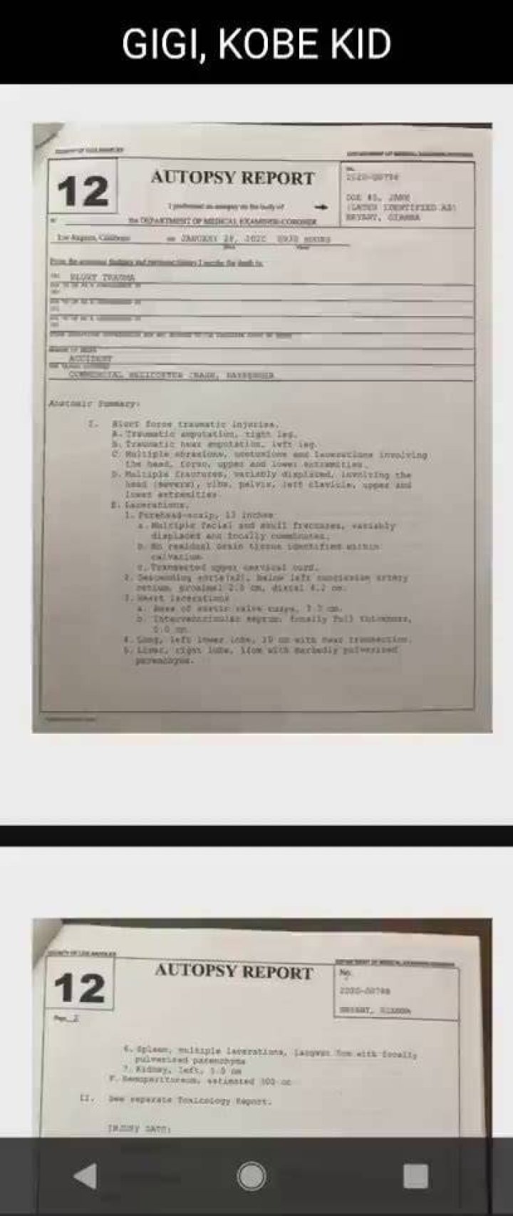 Kobe Bryant Autopsy Report Gigi Kobe Bryant accident explained