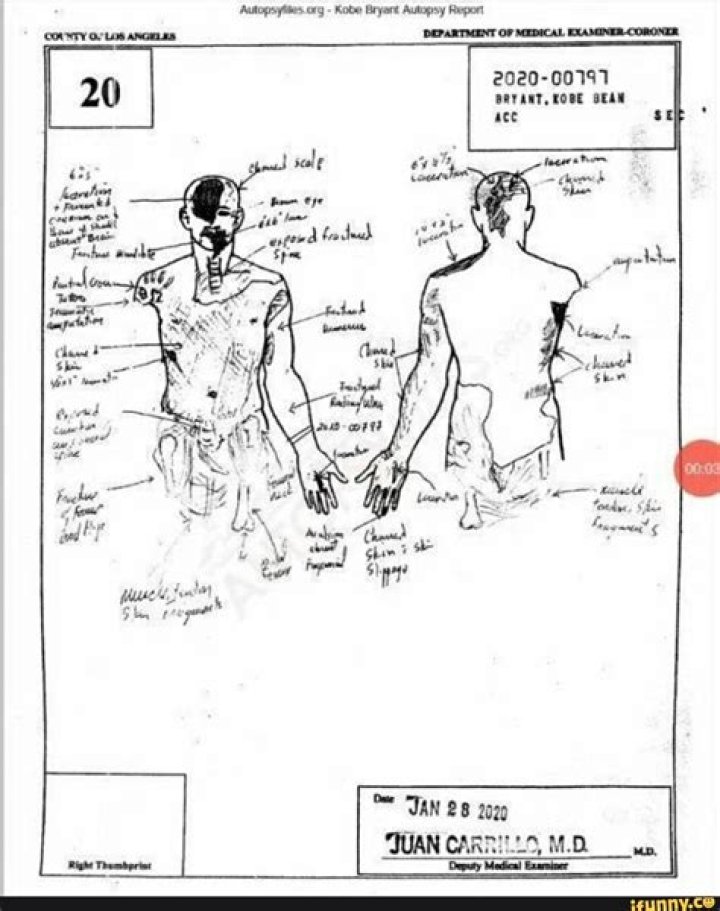 Kobe Bryant Autopsy Report Is Released After Helicopter Crash The New