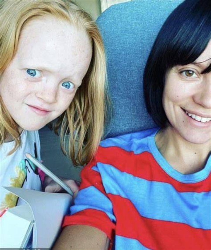 Lily Allen's Daughter's Forehead: A Comprehensive Guide