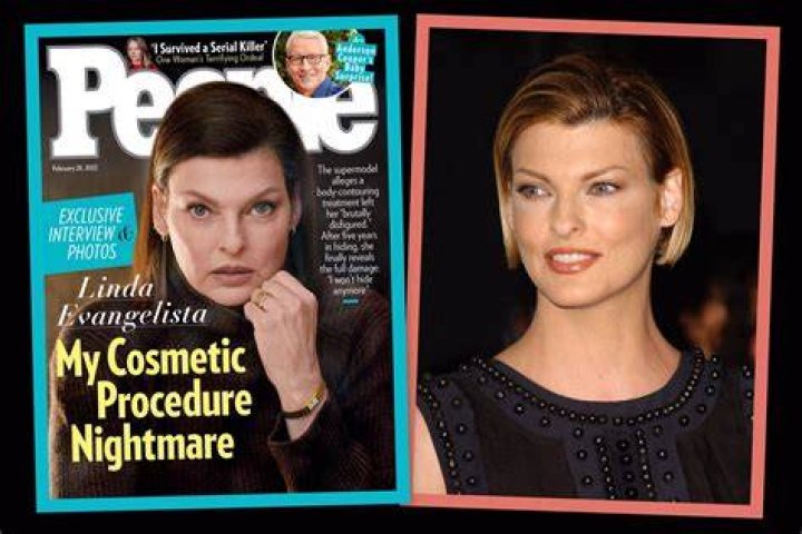 Linda Evangelista's Coolsculpting Journey: A Transformative Experience