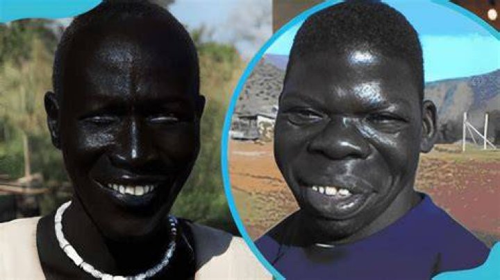 Meet The Darkest Man Alive: A True Story Of Melanin And Medical Marvels