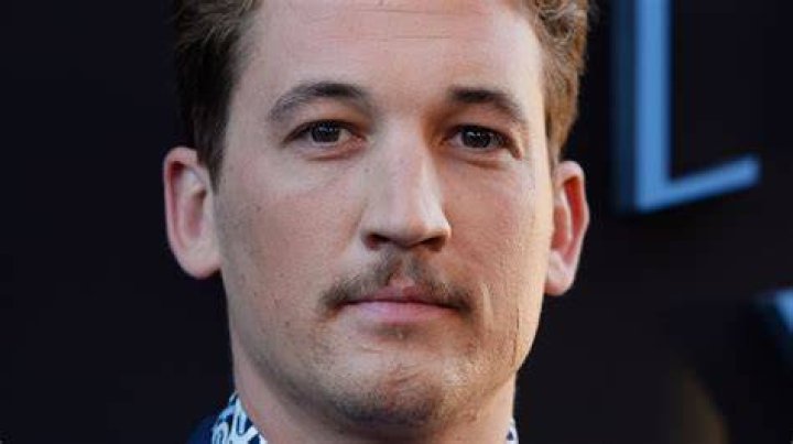 Miles Teller's Scars: The Inside Story Behind His Facial Markings