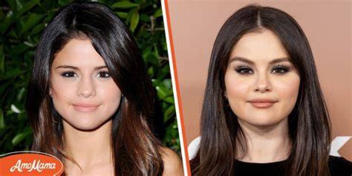 Selena Gomez & Plastic Surgery Experts Claim She Had Work Done