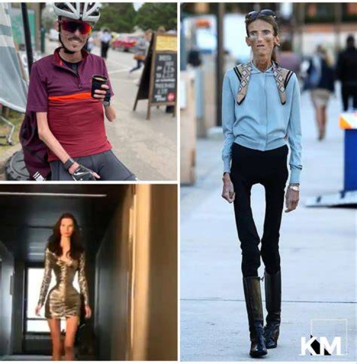 Skinniest Person