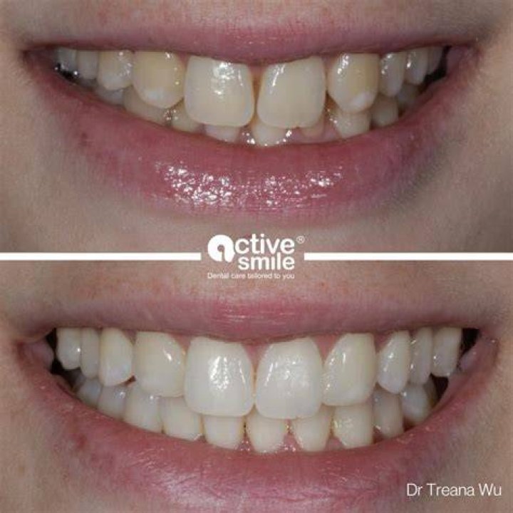 Smile Active Review: Discover The Truth Today