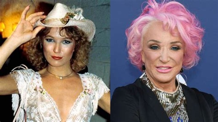 Tanya Tucker Plastic Surgery Totally Changed Her Face