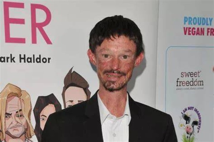 The Latest On Darren Kent's Battle With Scleroderma