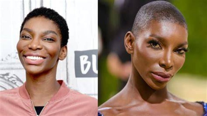The Truth About Michaela Coel's Recent Surgery