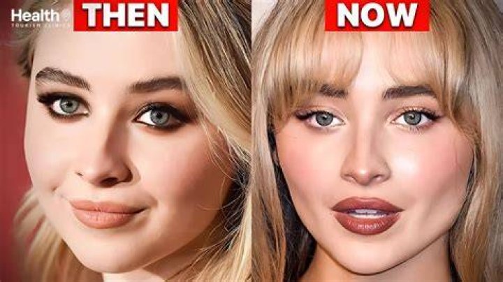 The Truth Unveiled: Is Sabrina Carpenter's Transformation Plastic Surgery Or Just Good Genes?