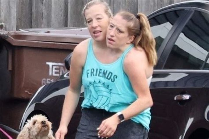Tragic Loss: The Lives And Deaths Of Abby And Brittany Hensel