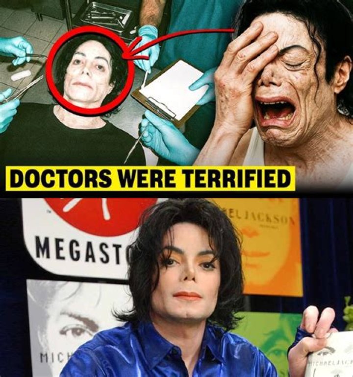 Uncovering The Truth: Michael Jackson's Autopsy Report Unraveled