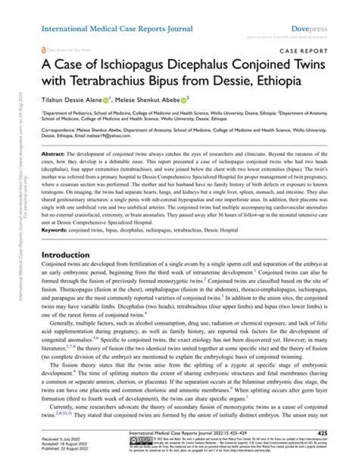 Unraveling The Enigma Of Dicephalus Conjoined Twins: An Exploration Of The Extraordinary And Perplexing