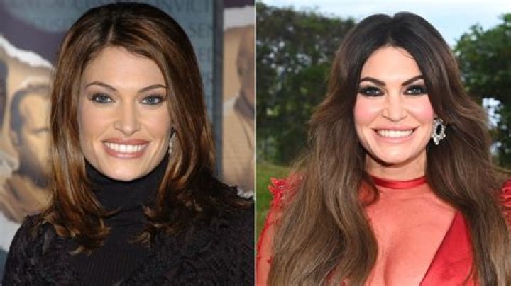 Unseen Before: Kimberly Guilfoyle's Face Unveiled