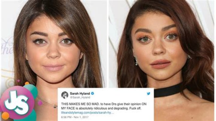 Unveiling Sarah Hyland's Plastic Surgery Journey: Discoveries And Insights