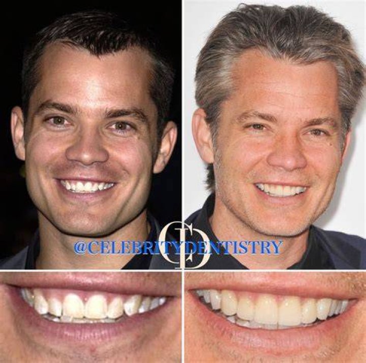 Unveiling The Charm: Timothy Olyphant's Teeth