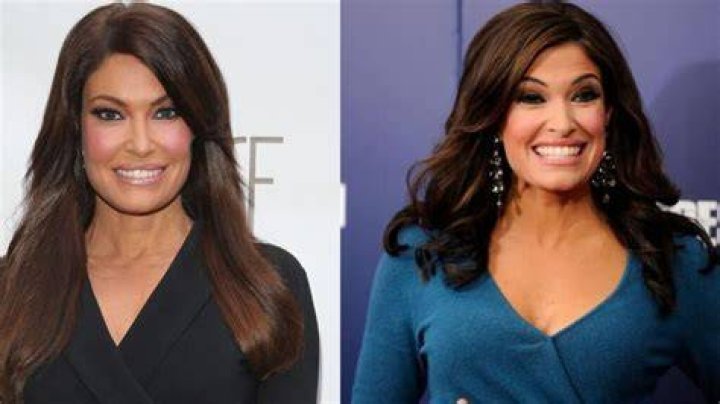 Unveiling The Transformation: The Story Behind Kimberly Gilfoyle's Plastic Surgery