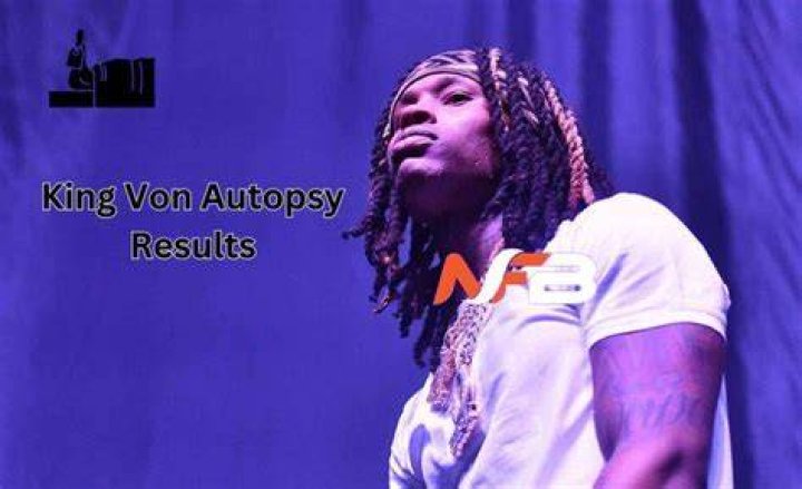 Unveiling The Truth: King Vin Autopsy Photos Revealed