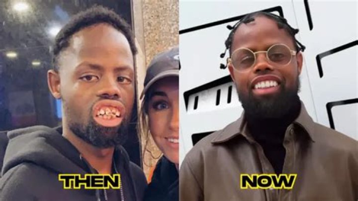 What Really Happened To Welven Da Great, Aka Deez Nuts Guy? Is The Deez