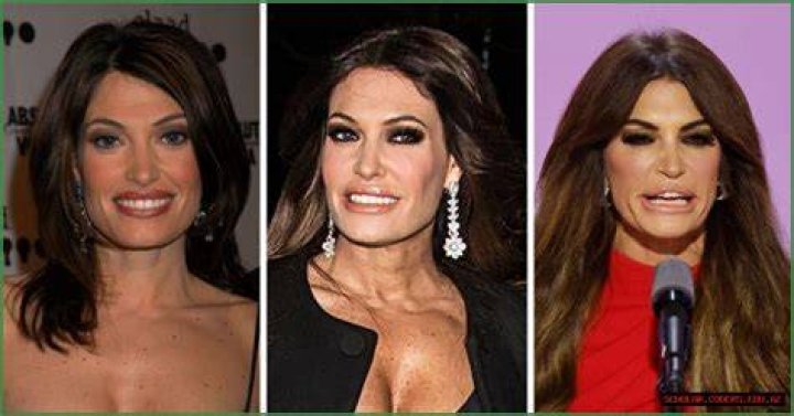 What's The Shocking Truth Behind Kimberly Guilfoyle's Changed Appearance?