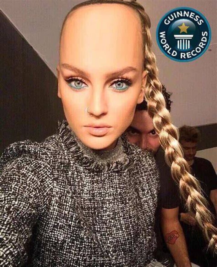 World's Largest Forehead - A Guinness Record Breaker